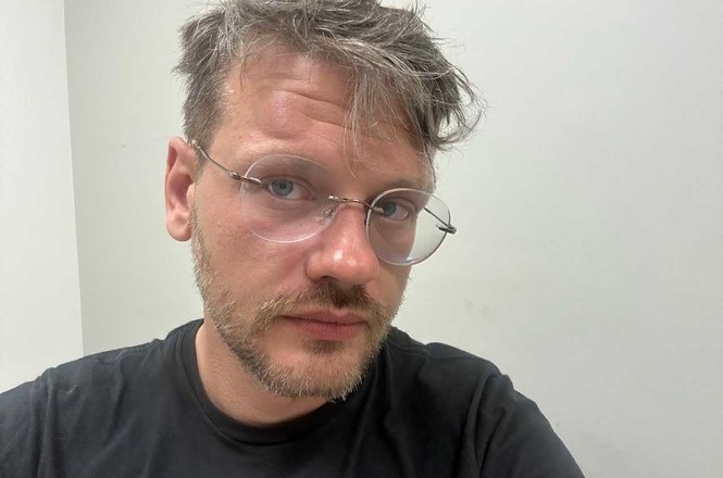 Freelance photojournalist Sean Beckner-Carmitchel with a lump on his temple after he was struck with a tear gas canister fired by federal officers while he was documenting anti-deportation protests in Compton, California, on June 7, 2025.