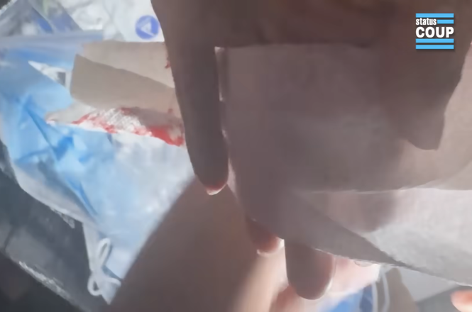 Status Coup journalist Tina-Desiree Berg, after being struck with a baton by a Los Angeles police officer amid anti-deportation protests in downtown Los Angeles on Aug. 8, 2025, filmed while cleaning blood from her injured hand.