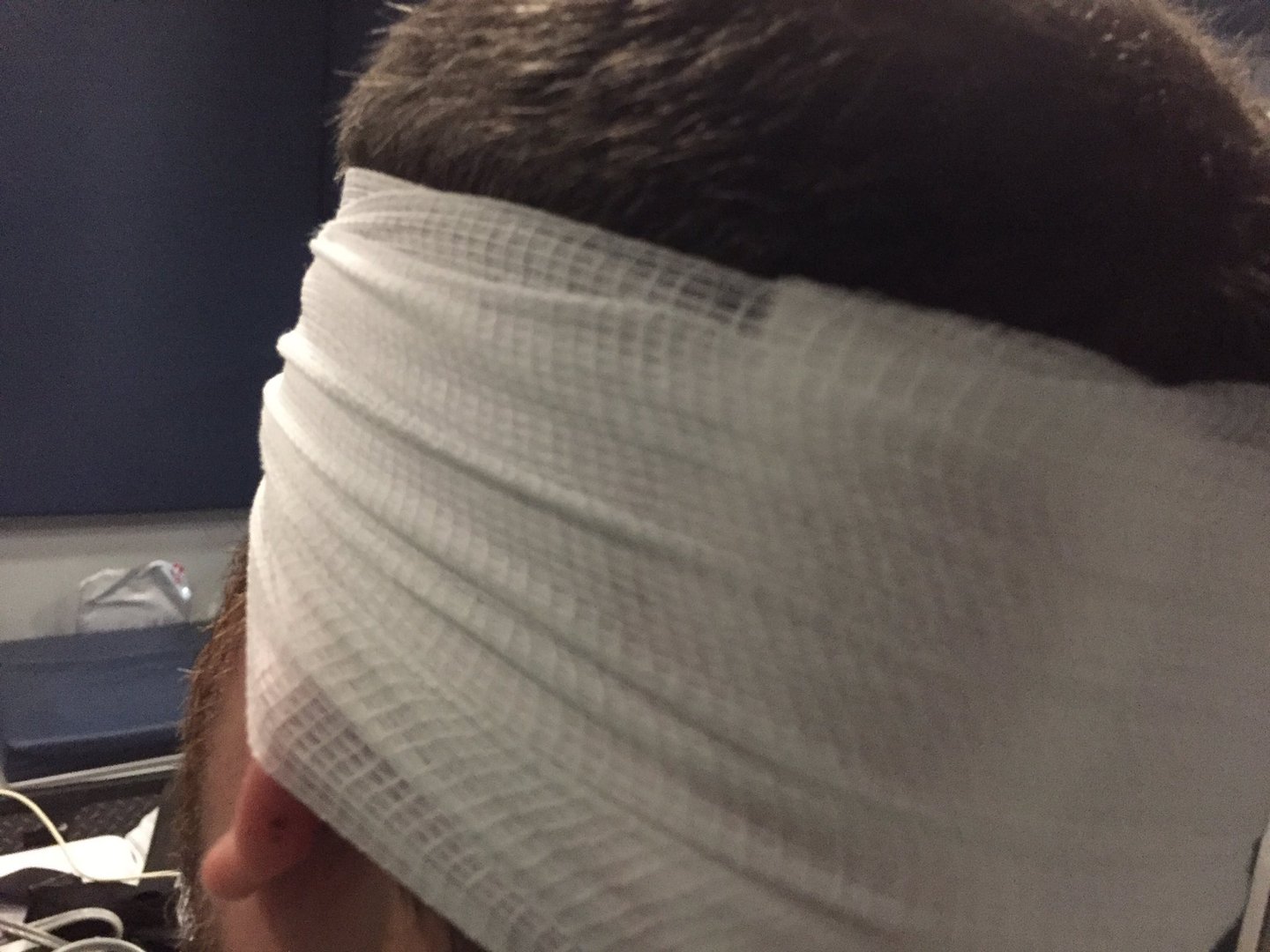 Injured CBS 6 photojournalist