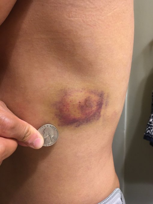 Courtesy Martin Hawk