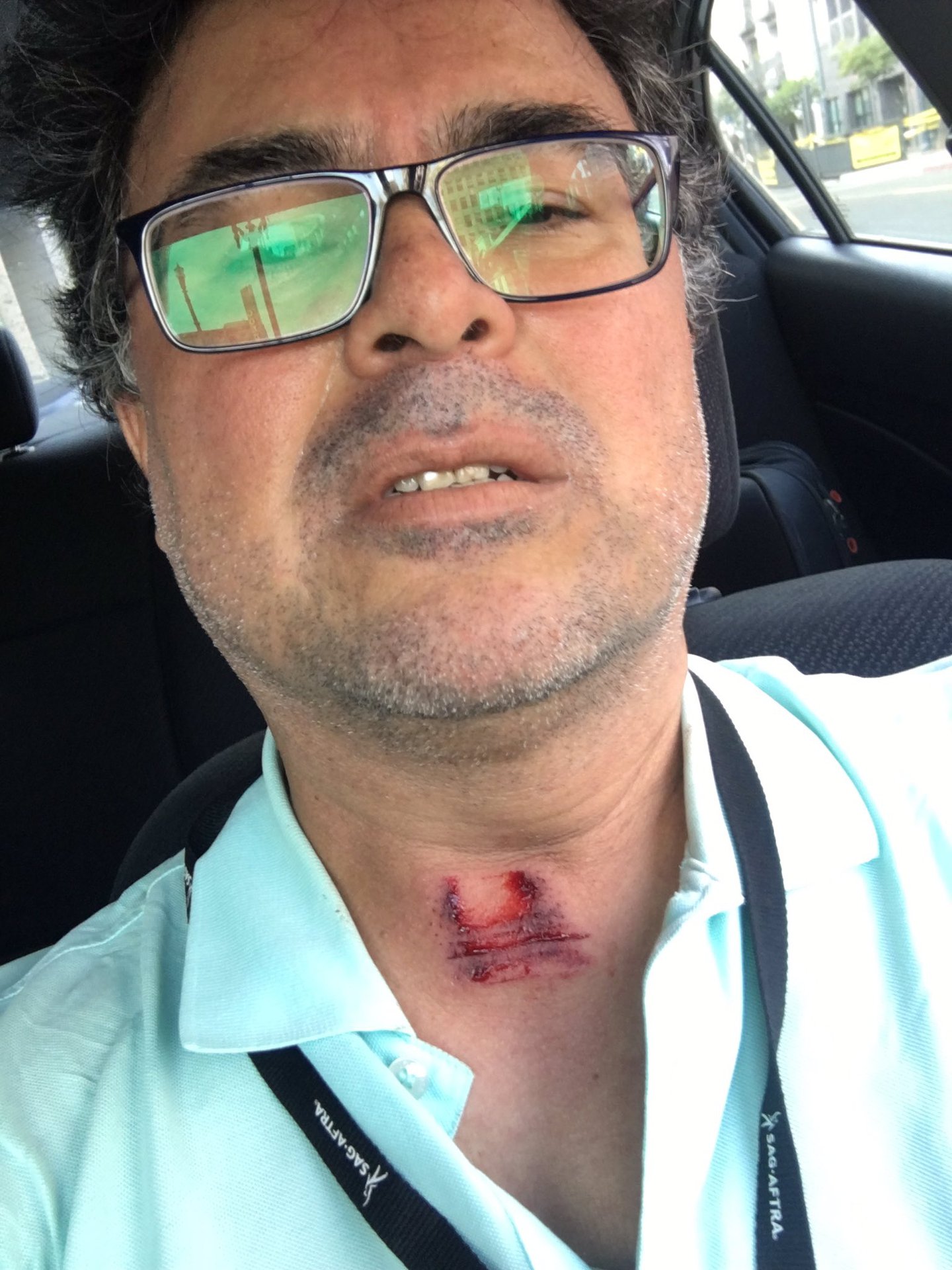 Guzman_Lopez_assault_0531_CA.jpg