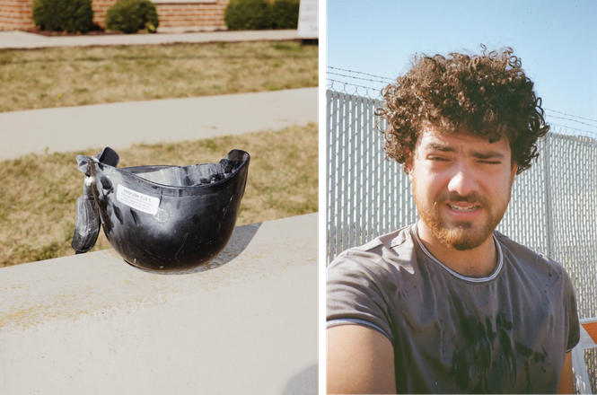 Photojournalist Zach Hussein, right, was shot 20-30 times with pepper balls by federal officers while covering protests at a Broadview, Illinois, immigration facility on Oct. 4, 2025. Impact marks from multiple rounds were visible on his helmet, left.
