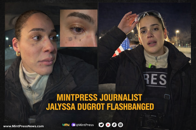 MintPress News reporter Jalyssa Dugrot shows an injury to her face, at left, after she was struck with crowd-control munitions while covering an immigration protest in the Minneapolis, Minnesota, area on Jan. 11, 2026.