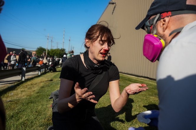 Journalist Leigh Kunkel is treated by a medic after federal officers shot her in the face and back of the head with pepper balls outside a U.S. Immigration and Customs Enforcement facility in the Chicago suburb of Broadview, Illinois, on Sept. 26, 2025.