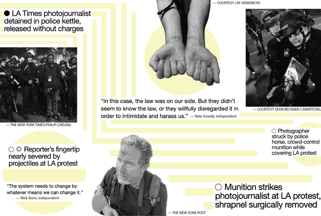 Images showing officers detaining and assaulting journalists, and their resulting injuries, during summer 2025 protests in Los Angeles, California.