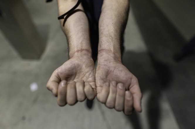 Photographer Nate Gowdy’s wrists after he was released from his zip-tie restraints. Gowdy and other journalists were detained by Los Angeles Police Department officers while covering a protest in LA on Aug. 8, 2025.